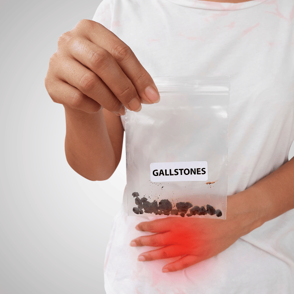 Dr Govind Yadav Best Surgeon In Gurgaon